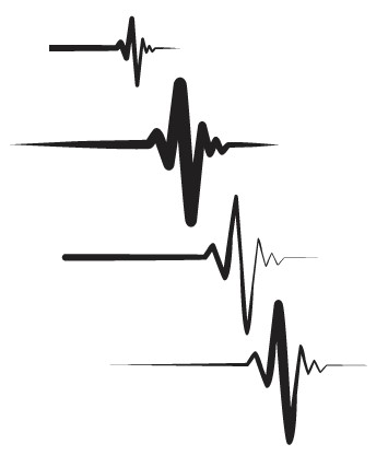 sample EKG graphics based off a standard heartbeat.